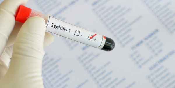 Сифилис лечение и профилактика| 
