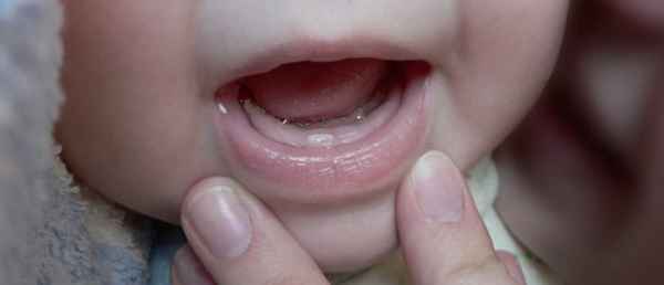 Появление первого зуба Первые зубки| 