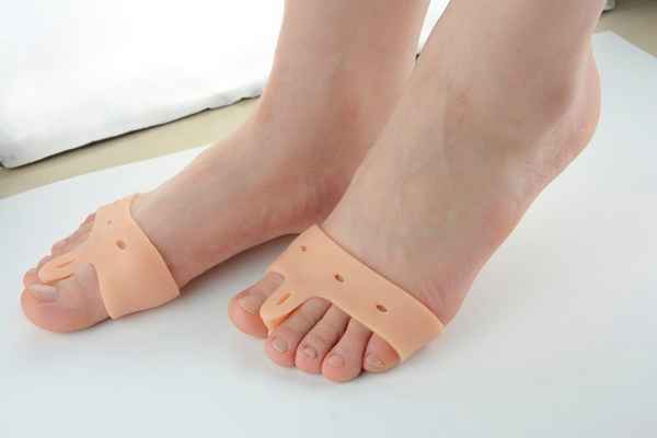 Косточки на ногах лечение, как вылечить косточки на ногах| 