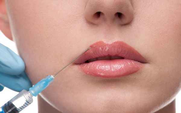 Увеличение губ гиалуроновой кислотой: отзывы| 