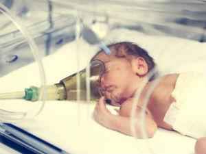 Асфиксия новорожденных: последствия при рождении, неотложная помощь